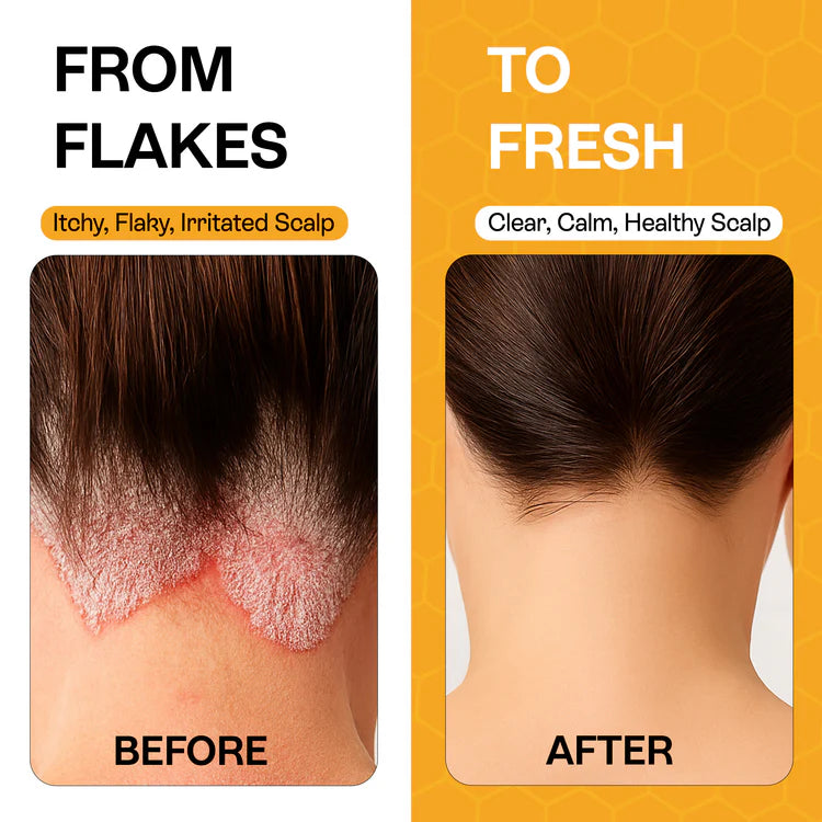 Hydrating scalp cleanser