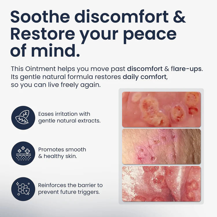 Genital Herpes Ointment for Men & Women | Soothing Relief for Itching, Burning & Irritation | 56g