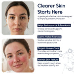 Azelaic Acid 15% Cream – Acne Control, Redness Relief & Tone Correction | 30ml