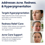 Azelaic Acid 15% Cream – Acne Control, Redness Relief & Tone Correction | 30ml