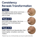 Melasma Cream & Dark Spot Remover for Skin Discoloration, Post-Blemish Marks, Scars & Spots