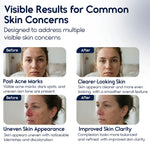 Azelaic Acid 15% Cream – Acne Control, Redness Relief & Tone Correction | 30ml