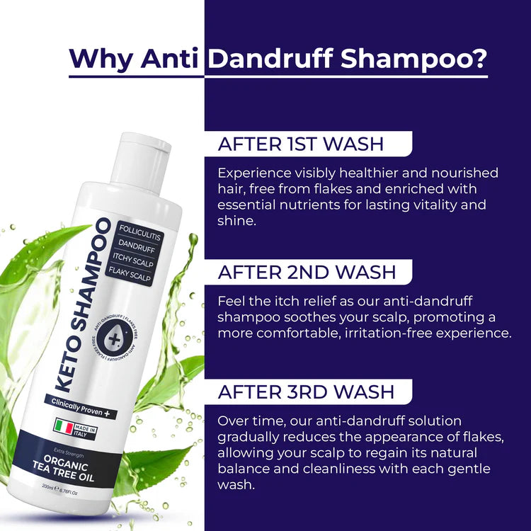 Keto Shampoo for Dandruff, Psoriasis, Folliculitis & Seborrheic Dermatitis | Anti-Fungal Itchy Scalp Relief