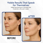 anti-aging skincare kit