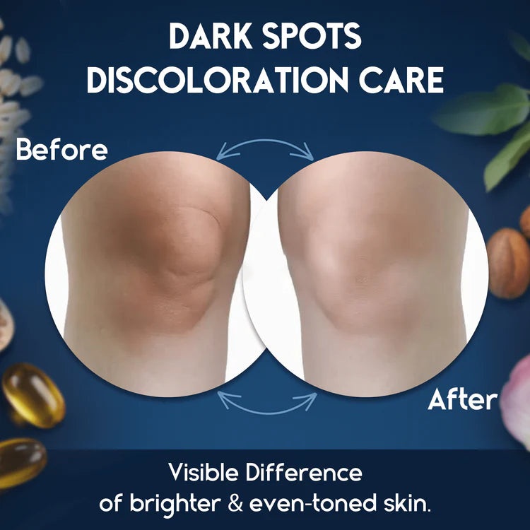 Dark Spot Corrector
