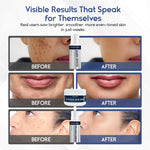brightening skincare bundle for dark spots