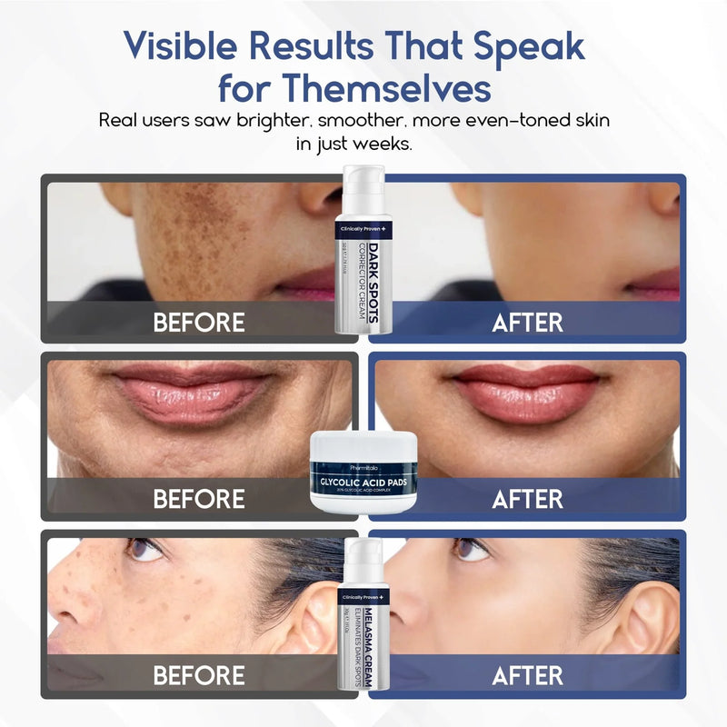 brightening skincare bundle for dark spots