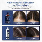 scalp and hair treatment kit