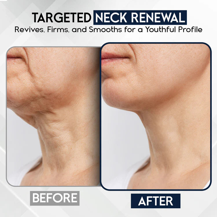 Neck Firming & Tightening Cream for Sagging Skin & Wrinkles