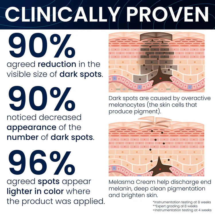 Melasma Cream & Dark Spot Remover for Skin Discoloration, Post-Blemish Marks, Scars & Spots