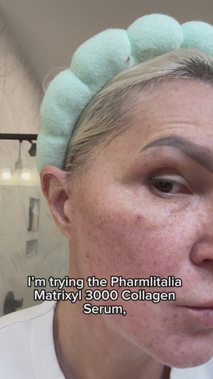 The results are visible