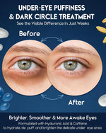 Retinol Eye Cream – Reduces Fine Lines, Puffiness & Dark Circles | 15ml