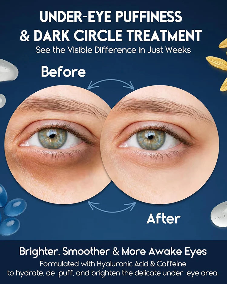 Retinol Eye Cream – Reduces Fine Lines, Puffiness & Dark Circles | 15ml