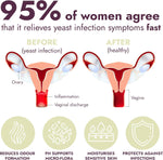 yeast infection treatment for pregnant women